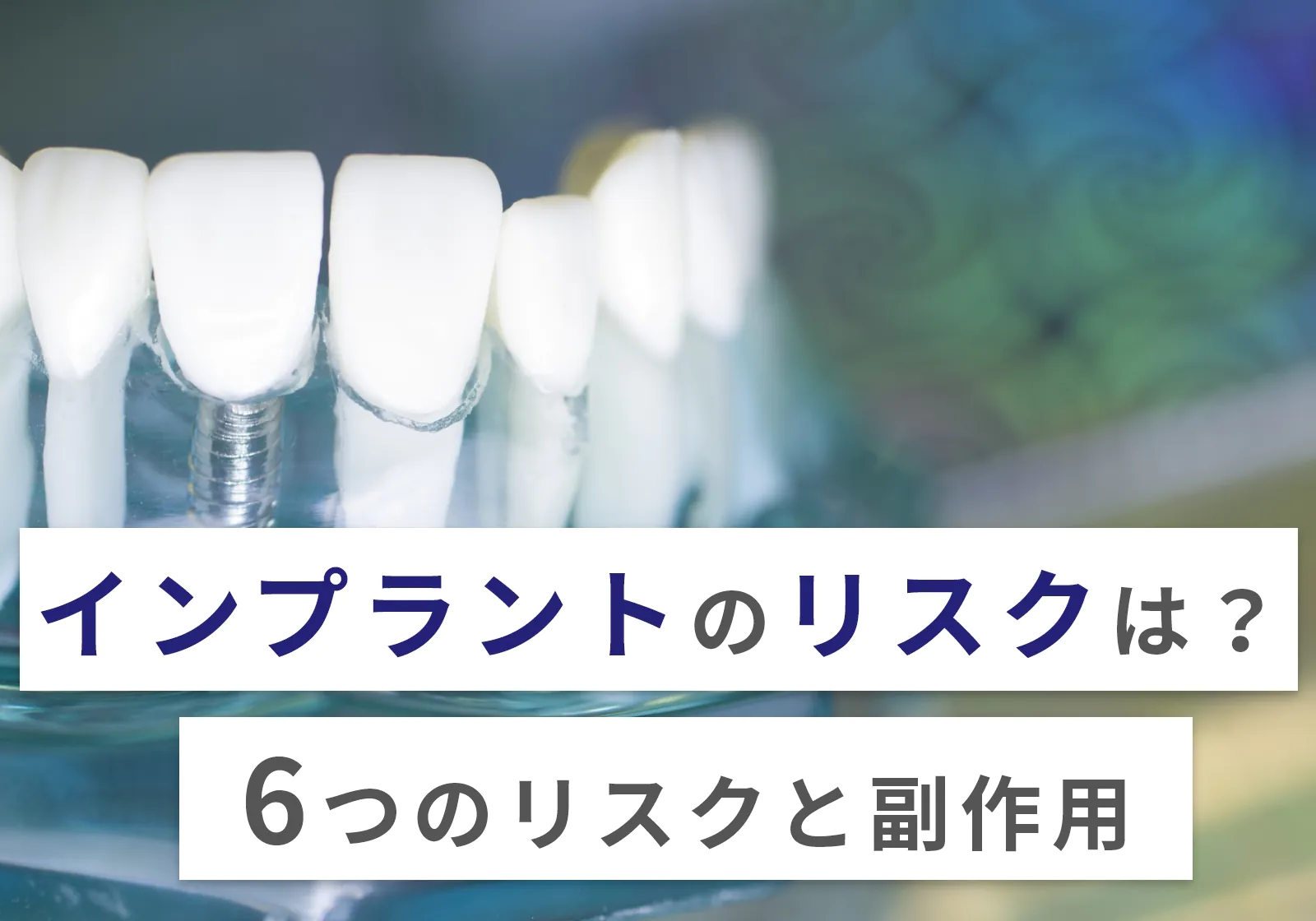 【歯科医が教える】インプラントのリスク6つ！副作用についても解説