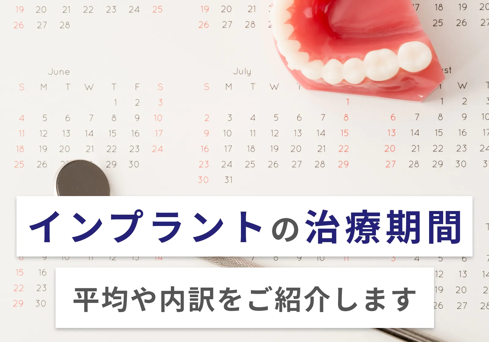 インプラントの平均治療期間は7.5ヶ月！最短で3ヶ月！歯がない期間や食事について解説